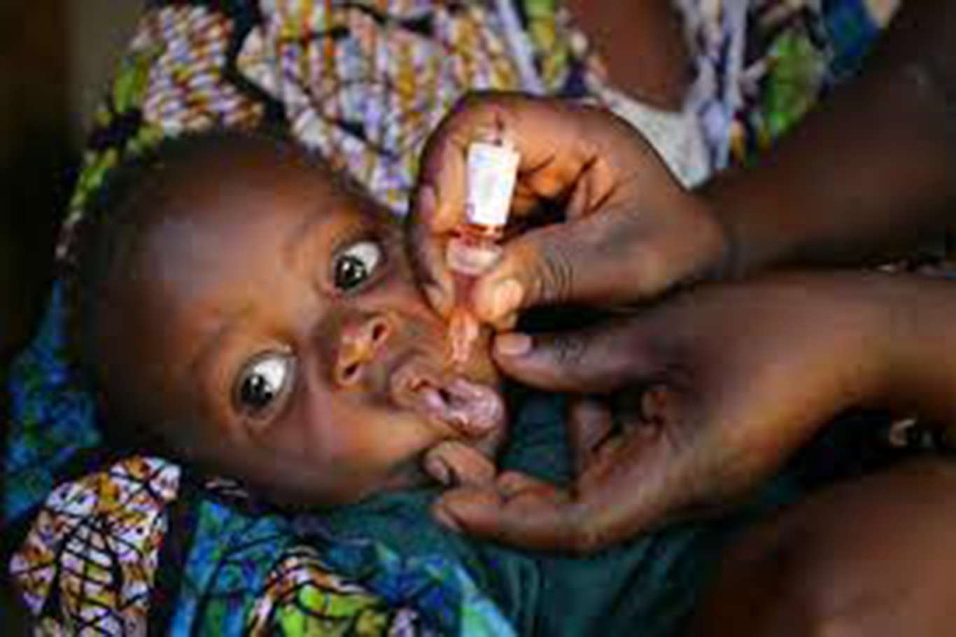  اكتشاف حالة  أخرى لشلل الأطفال  في موزمبيق
